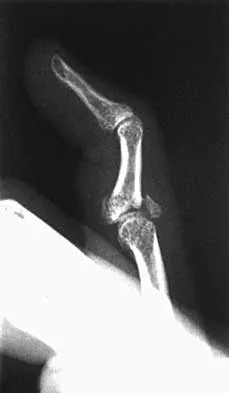 Trauma Board Review 2000: High-Yield MCQs (Set 2) - Figure 15
