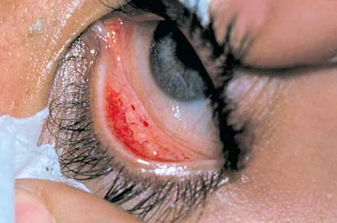 Trauma Board Review 2000: High-Yield MCQs (Set 2) - Figure 23