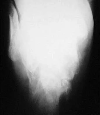 Trauma Board Review 2000: High-Yield MCQs (Set 2) - Figure 25