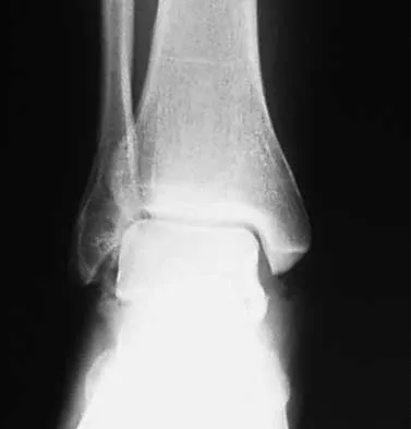 Trauma Board Review 2000: High-Yield MCQs (Set 2) - Figure 27