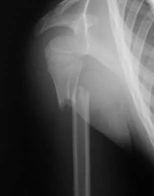Trauma Board Review 2000: High-Yield MCQs (Set 2) - Figure 28