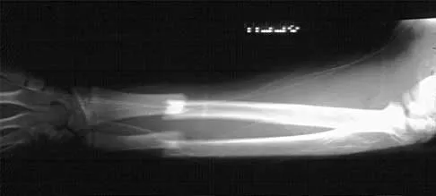 Trauma Board Review 2000: High-Yield MCQs (Set 2) - Figure 3