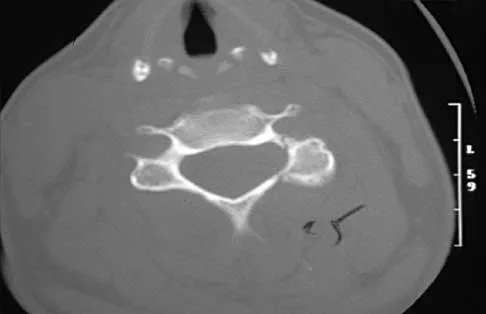 Trauma 2000 Practice Questions: Set 3 (Solved) - Figure 18