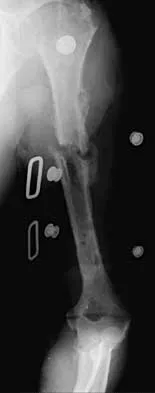 Trauma 2000 Practice Questions: Set 3 (Solved) - Figure 22