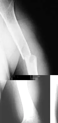 Trauma 2000 Practice Questions: Set 3 (Solved) - Figure 4