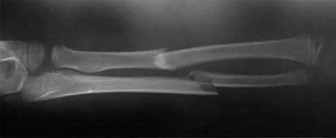 Trauma Board Review 2000: High-Yield MCQs (Set 4) - Figure 10