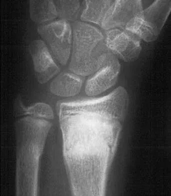 Trauma Board Review 2000: High-Yield MCQs (Set 4) - Figure 15