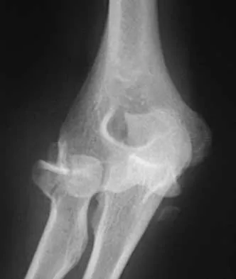 Trauma Board Review 2000: High-Yield MCQs (Set 4) - Figure 16