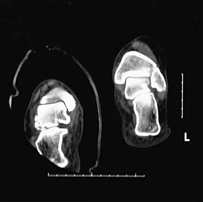 Trauma Board Review 2000: High-Yield MCQs (Set 4) - Figure 21