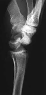 Trauma Board Review 2000: High-Yield MCQs (Set 4) - Figure 22