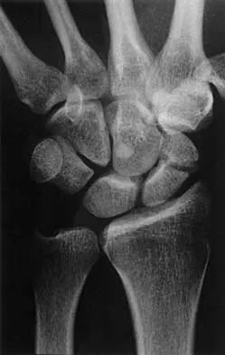 Trauma Board Review 2000: High-Yield MCQs (Set 4) - Figure 4