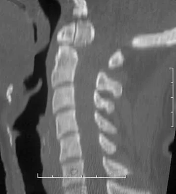 Trauma Board Review 2000: High-Yield MCQs (Set 4) - Figure 6
