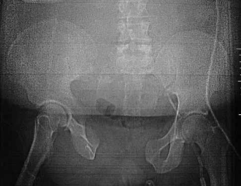 Trauma 2006 Practice Questions: Set 1 (Solved) - Figure 2