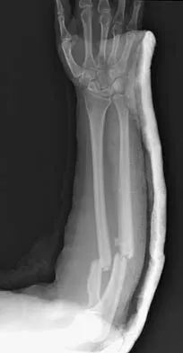 Trauma 2006 Practice Questions: Set 1 (Solved) - Figure 20
