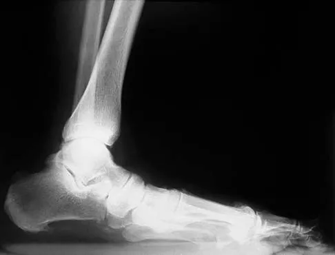 Trauma 2006 Practice Questions: Set 1 (Solved) - Figure 28