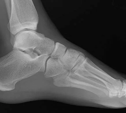 Trauma 2006 Practice Questions: Set 1 (Solved) - Figure 29