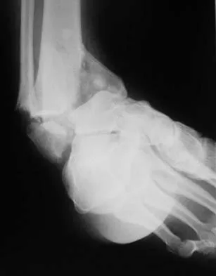 Trauma 2006 Practice Questions: Set 1 (Solved) - Figure 6