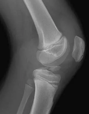 Trauma 2006 Practice Questions: Set 1 (Solved) - Figure 7