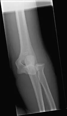 Trauma Board Review 2006: High-Yield MCQs (Set 2) - Figure 1