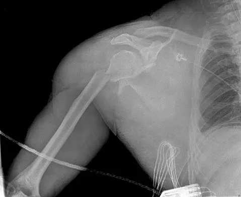 Trauma Board Review 2006: High-Yield MCQs (Set 2) - Figure 12