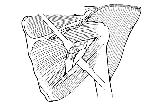 Trauma Board Review 2006: High-Yield MCQs (Set 2) - Figure 13