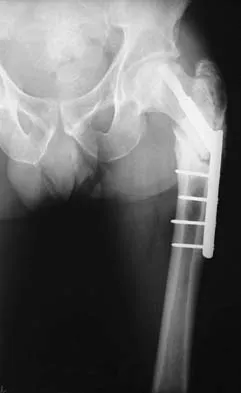 Trauma Board Review 2006: High-Yield MCQs (Set 2) - Figure 16