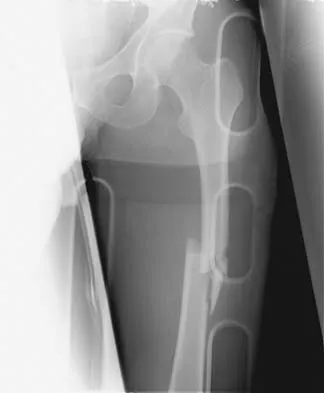 Trauma Board Review 2006: High-Yield MCQs (Set 2) - Figure 24