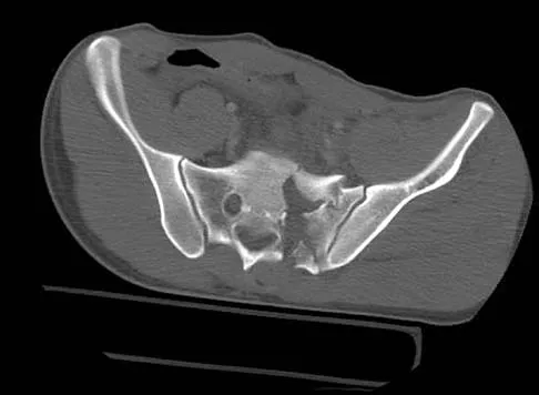 Trauma Board Review 2006: High-Yield MCQs (Set 2) - Figure 28