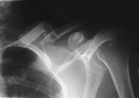 Trauma Board Review 2006: High-Yield MCQs (Set 2) - Figure 30
