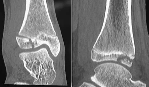 Trauma Board Review 2006: High-Yield MCQs (Set 2) - Figure 32