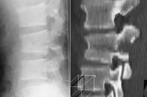 Trauma Board Review 2006: High-Yield MCQs (Set 2) - Figure 33