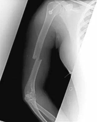 Trauma Board Review 2006: High-Yield MCQs (Set 2) - Figure 35