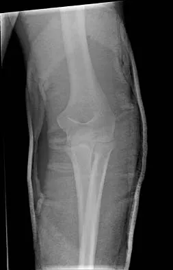 Trauma Board Review 2006: High-Yield MCQs (Set 2) - Figure 4
