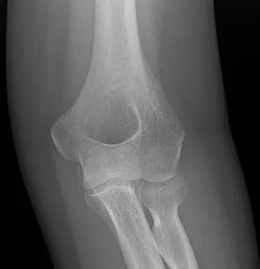 Trauma 2006 Practice Questions: Set 3 (Solved) - Figure 12