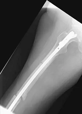 Trauma 2006 Practice Questions: Set 3 (Solved) - Figure 17