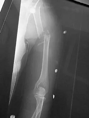 Trauma 2006 Practice Questions: Set 3 (Solved) - Figure 2