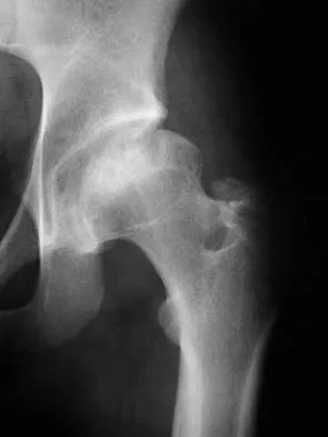 Trauma 2006 Practice Questions: Set 3 (Solved) - Figure 20