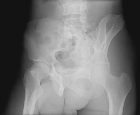 Trauma 2006 Practice Questions: Set 3 (Solved) - Figure 4