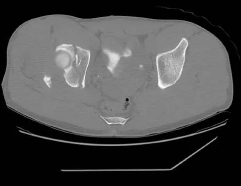 Trauma 2006 Practice Questions: Set 3 (Solved) - Figure 6