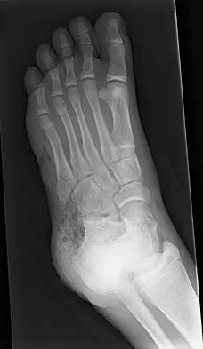 Trauma 2006 MCQs - Part 4