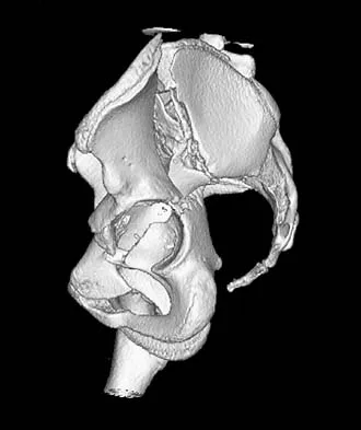 Trauma Board Review 2006: High-Yield MCQs (Set 4) - Figure 11