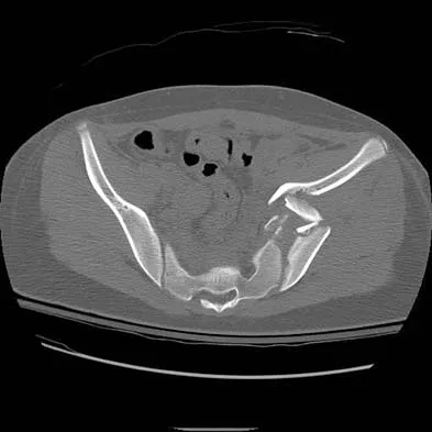Trauma Board Review 2006: High-Yield MCQs (Set 4) - Figure 13