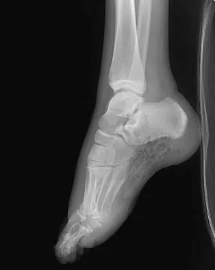 Trauma Board Review 2006: High-Yield MCQs (Set 4) - Figure 2