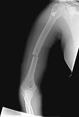 Click to enlarge Trauma Board Review 2006: High-Yield MCQs (Set 4) - Figure 21