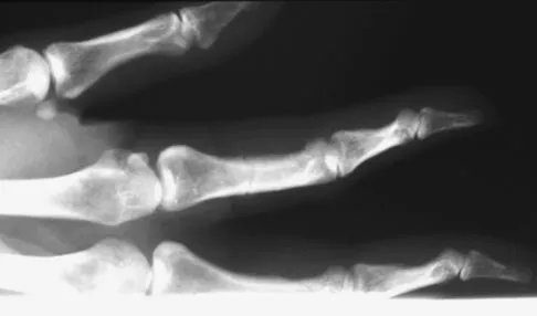 Trauma 2009 Practice Questions: Set 1 (Solved) - Figure 10