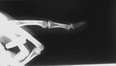 Trauma 2009 Practice Questions: Set 1 (Solved) - Figure 11