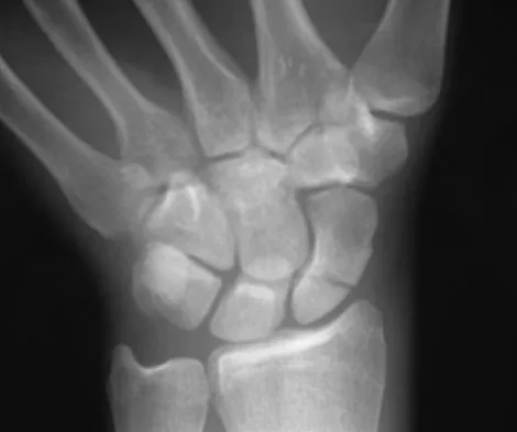 Trauma 2009 Practice Questions: Set 1 (Solved) - Figure 12