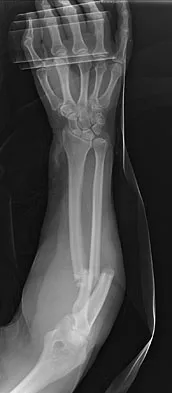 Trauma 2009 Practice Questions: Set 1 (Solved) - Figure 13