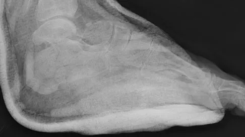 Trauma 2009 Practice Questions: Set 1 (Solved) - Figure 15