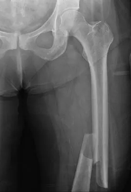 Trauma 2009 Practice Questions: Set 1 (Solved) - Figure 16
